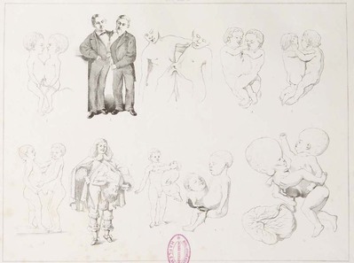 2965
<br/>
Die Missbildungen des Menschen : eine systematische Darstellung der beim Menschen angeboren vorkommenden Missbildungen und Erklärung ihrer Entstehungsweise.
<br/>
<em></em>